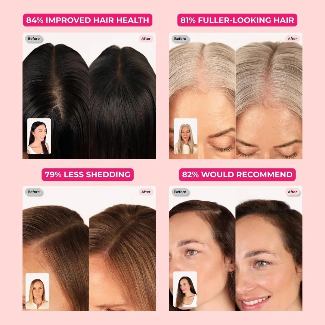 Folly hair-results comparison creative